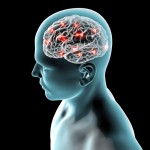 brain-based therapy